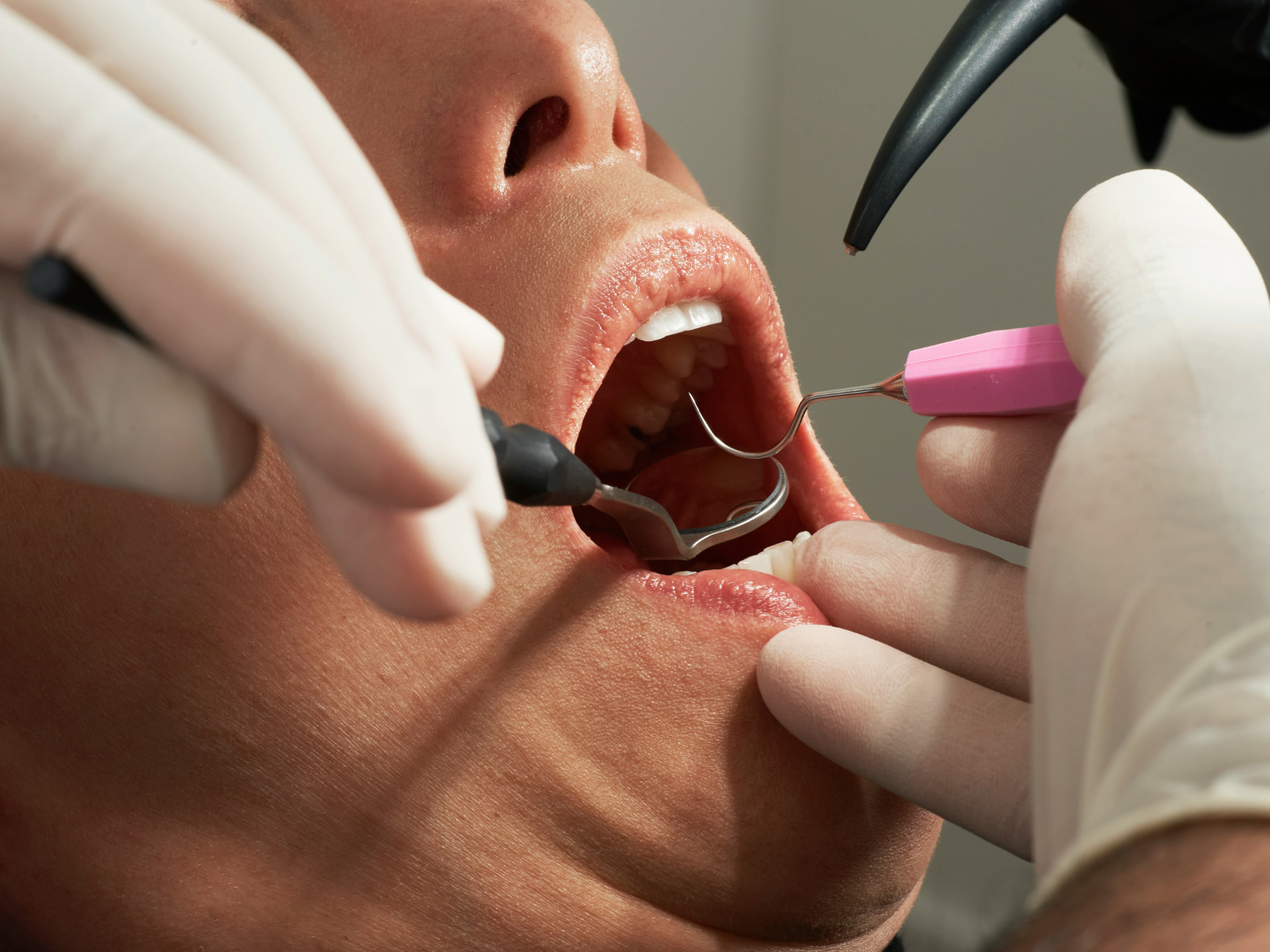 Dental Cleaning at Aroma Dental in Humble, TX: a hygienist scaling and polishing a patient's teeth during a professional dental cleaning