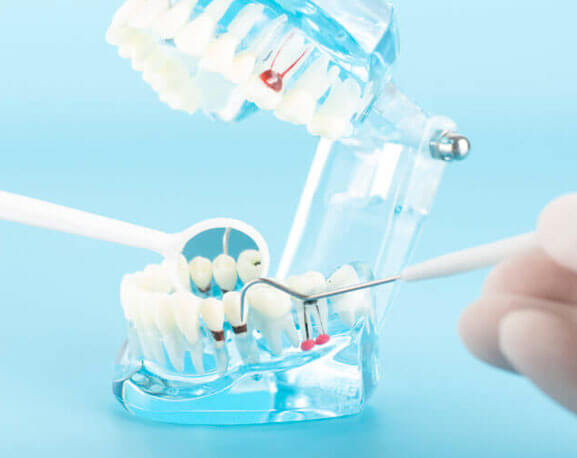 IMPLANT DENTISTRY