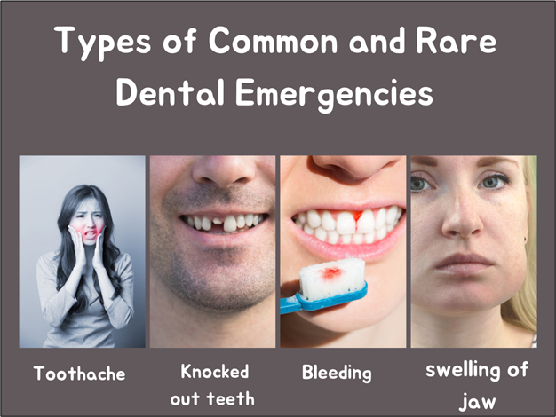 Rare Dental Emergencies