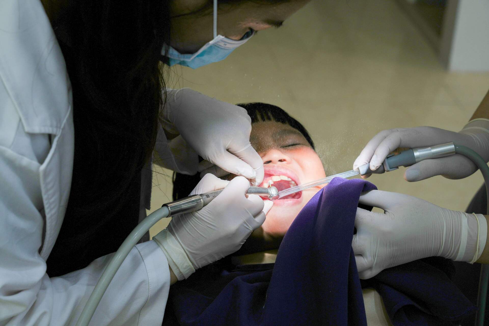 Veneer or crown dental procedure