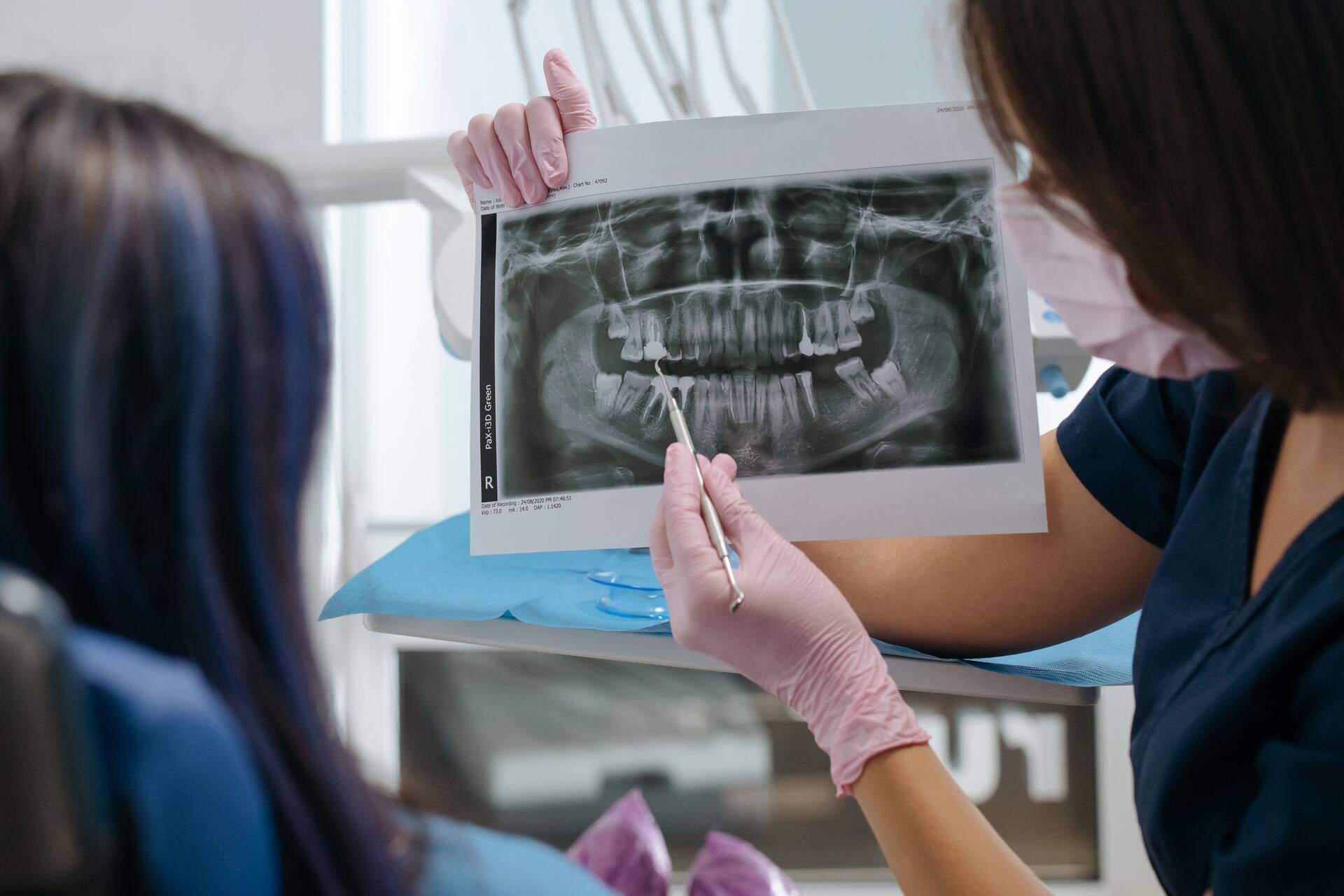 3D X-ray imaging for dental implant planning