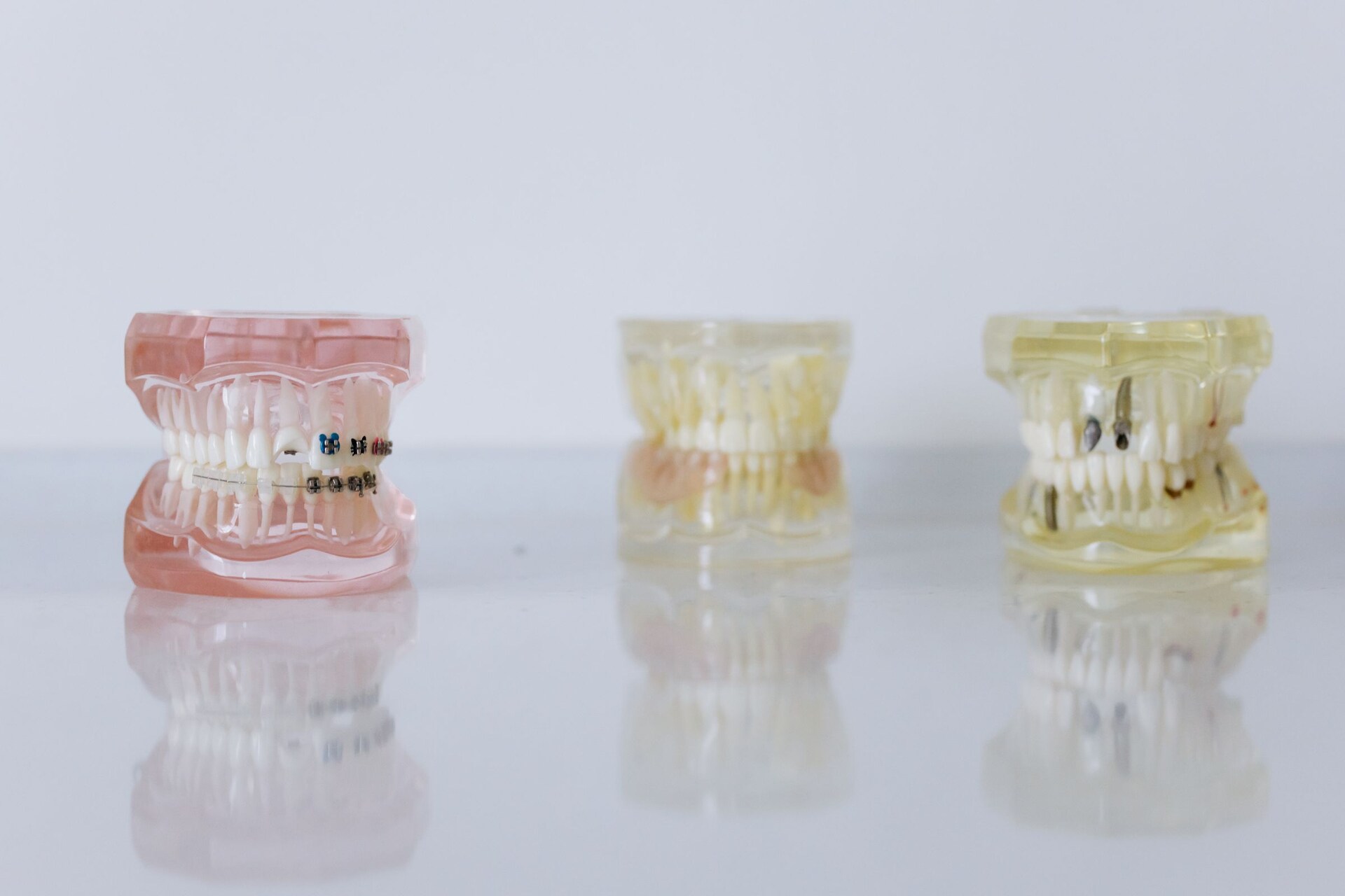 Dental implant model